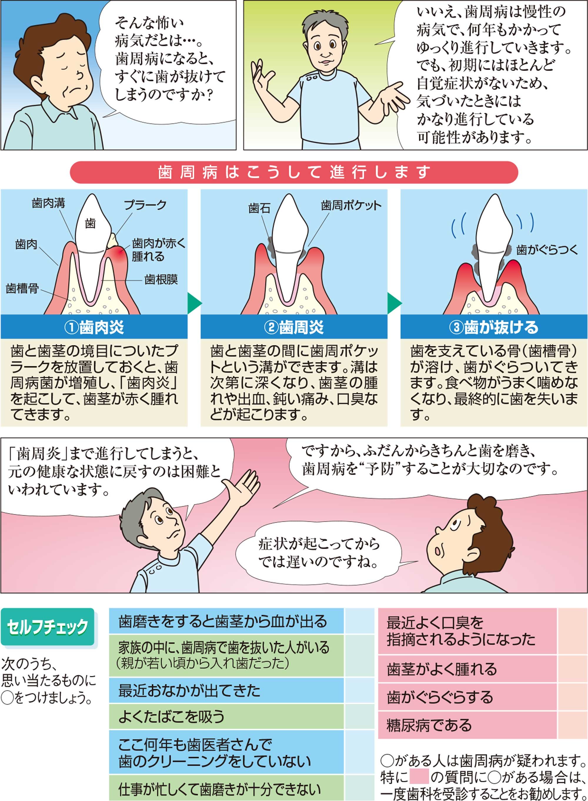 歯周病の進行、歯周病の疑いセルフチェック