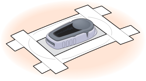 よくあるご質問・エラー時の対処方法 | Dexcom G6 | 持続血糖測定